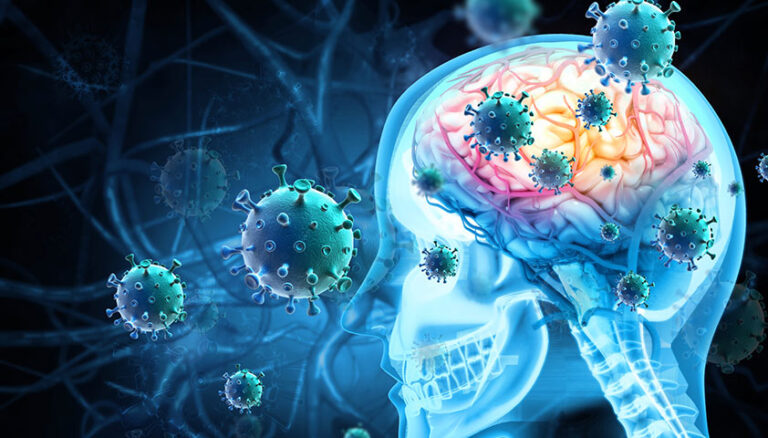 Что такое менингит? Как передается менингит? Как проявляется менингит?