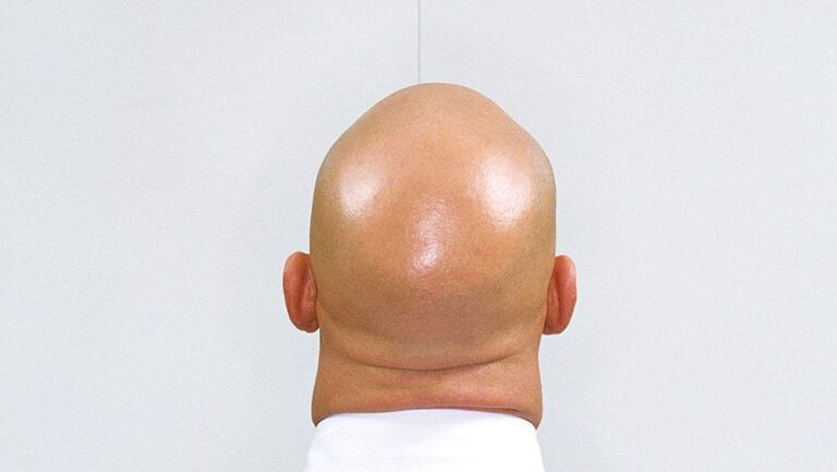 Почему выпадают волосы?